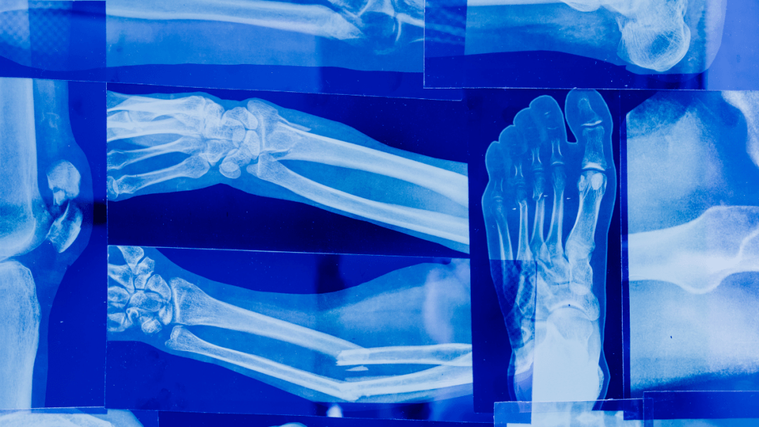 Bone and Joint Health: The Complete Guide to Stronger Bones & Better Mobility