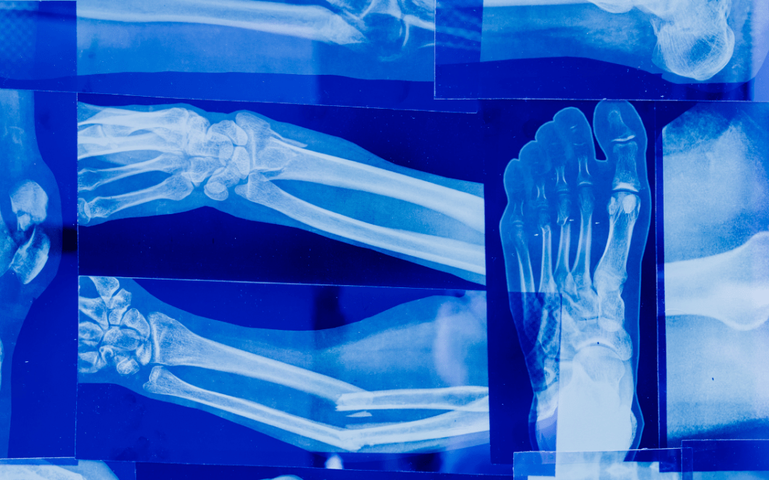 Bone and Joint Health: The Complete Guide to Stronger Bones & Better Mobility