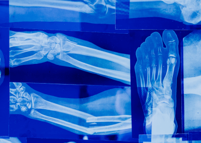 Bone and Joint Health: The Complete Guide to Stronger Bones & Better Mobility